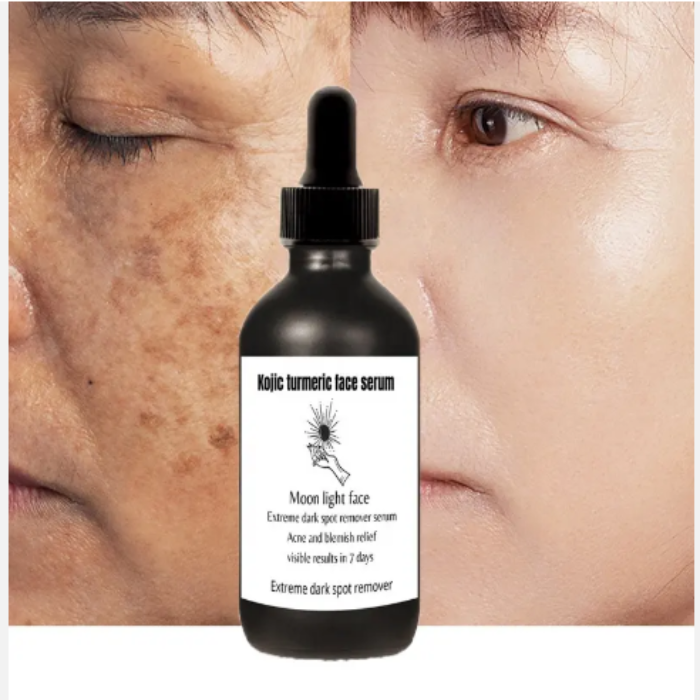 Kojic Turmeric Serum 30 ml