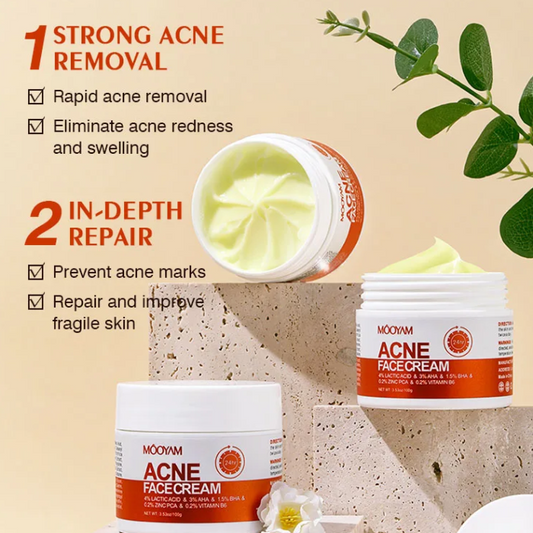 Acne face cream with lactic acid, AHA, BHA, Zinc PCA