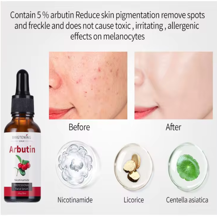 Arbutin Brightening Serum 30 ml
