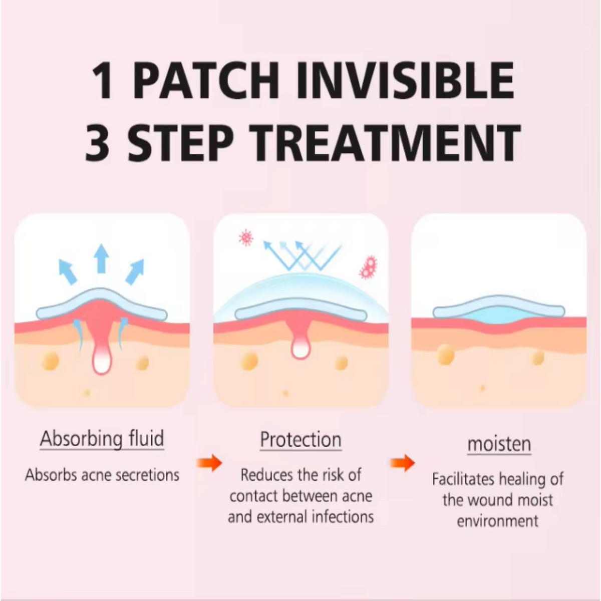 Invisible Patch Acne Treatment: Invincible Acne Patch – GlamHub Ventures